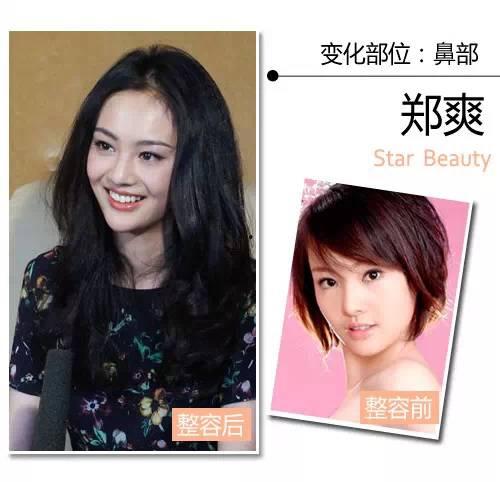 明星整容都去哪里,全球热门整形机构大盘点